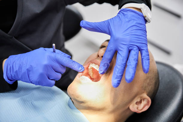 Best Emergency Dental Care for Sports Injuries in Cayuga Heights, NY